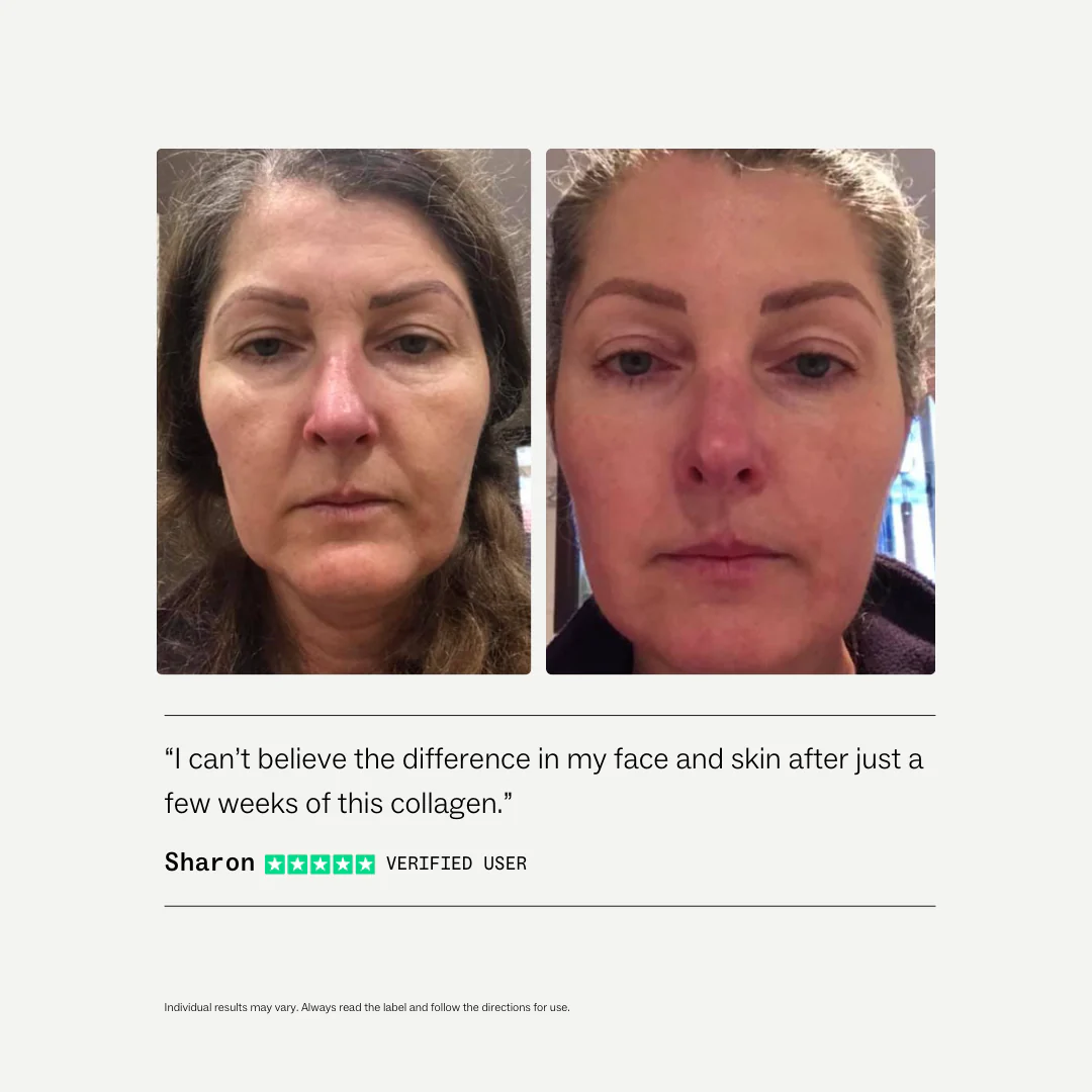Collagen Restore® - Image 4