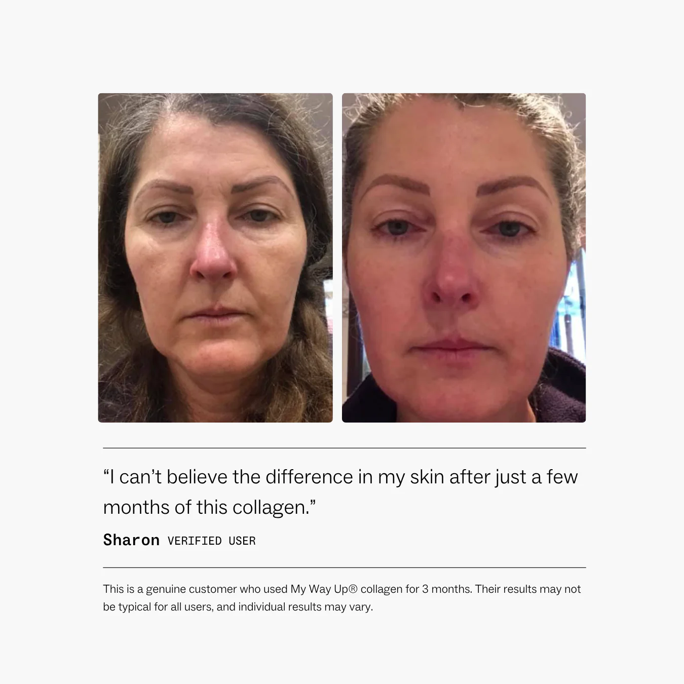 Collagen Restore™ - Image 5