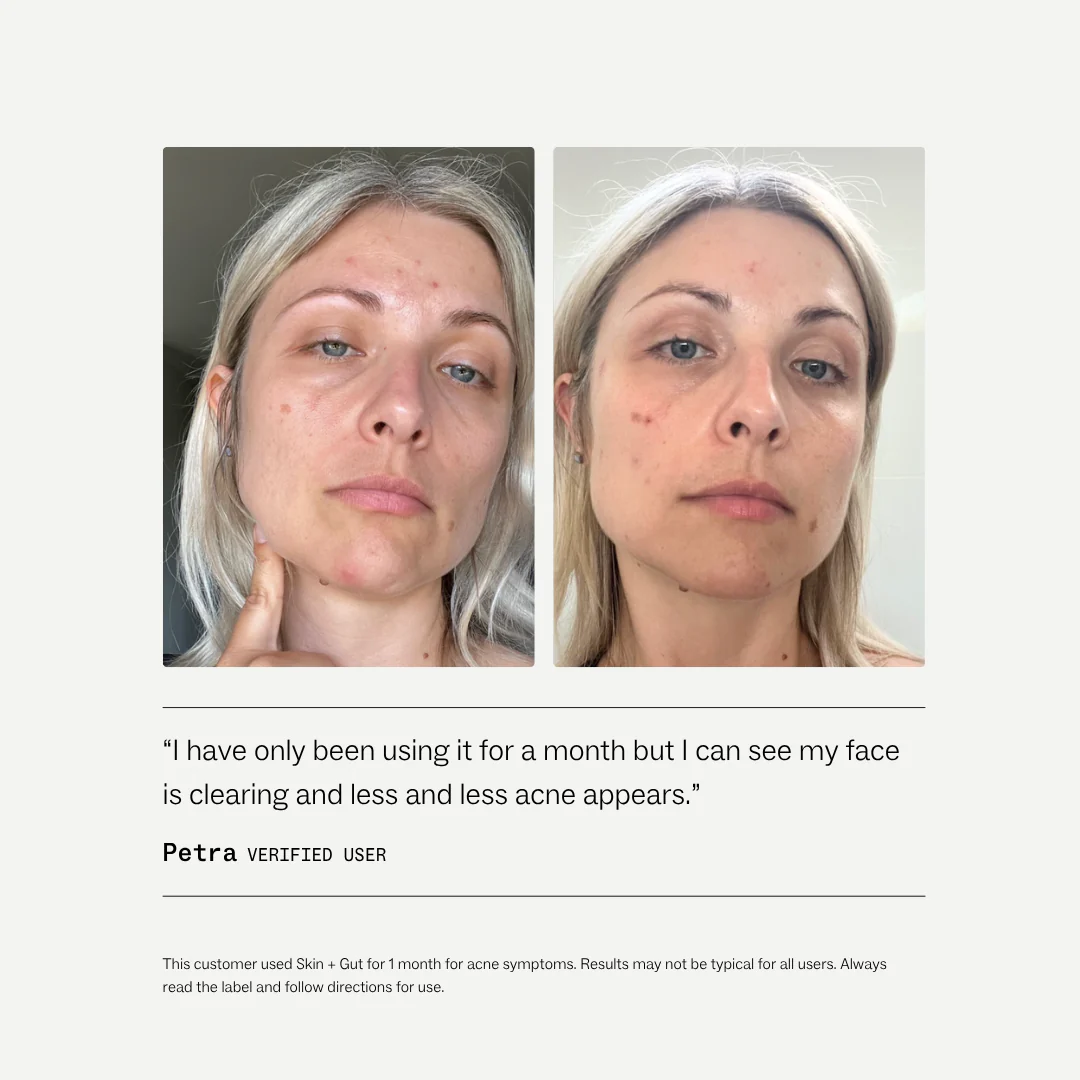 Skin + Gut™ - Image 7