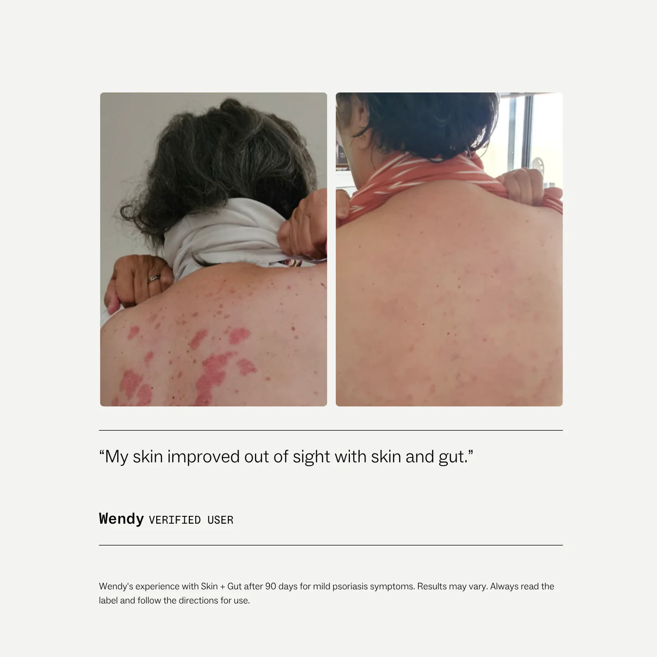Skin + Gut™ - Image 8