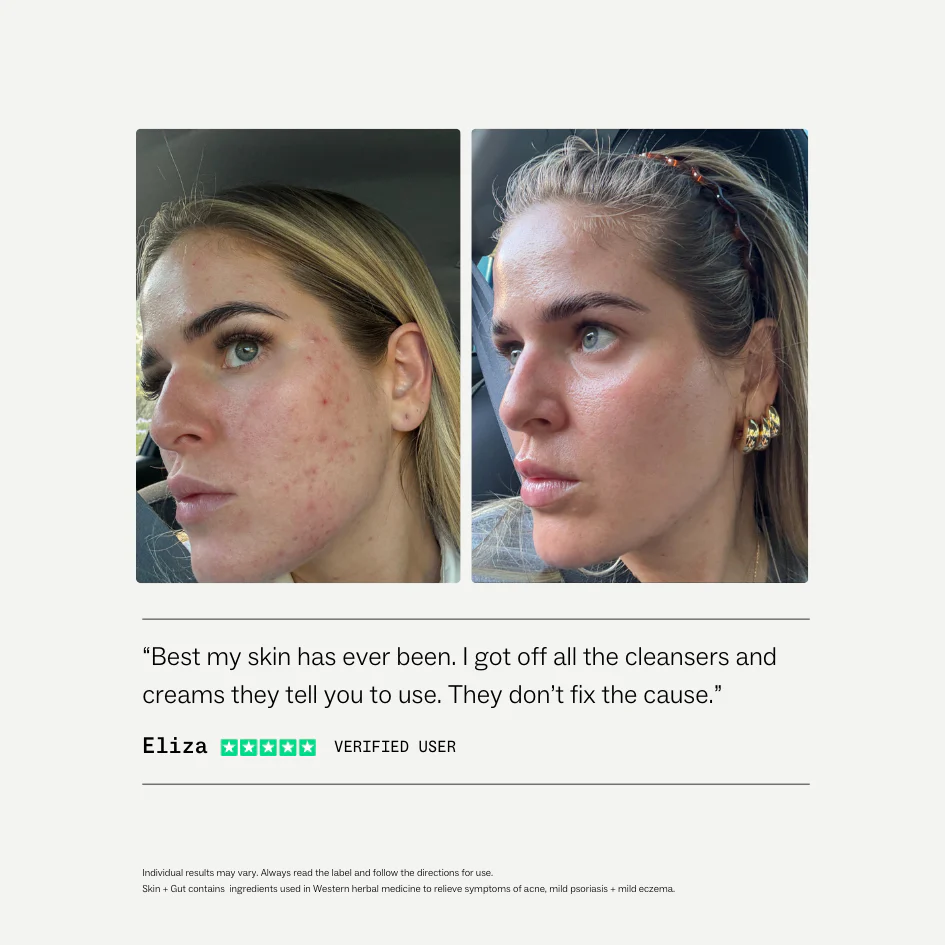Skin + Gut® - Image 4