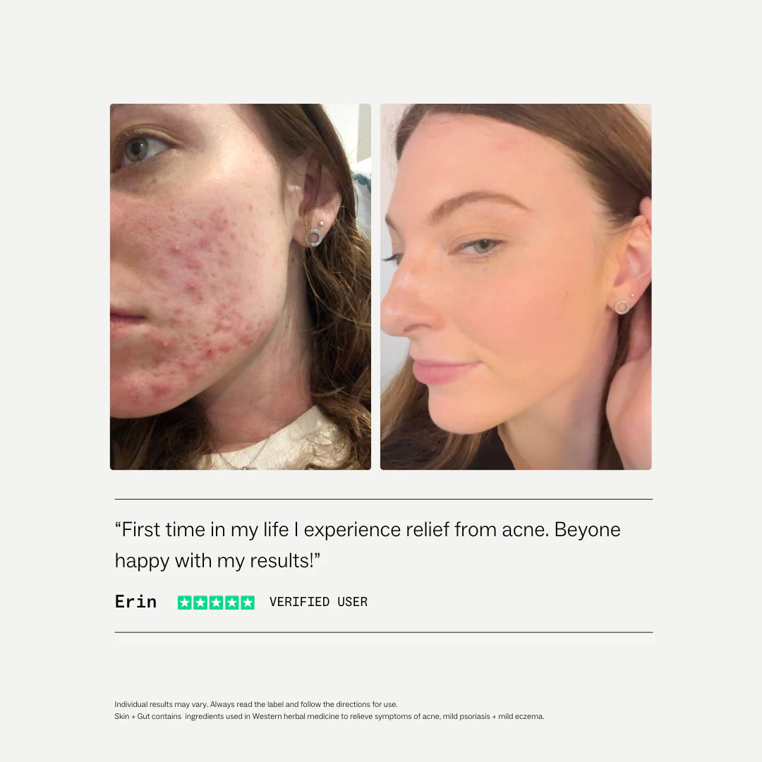 Skin + Gut® - Image 5