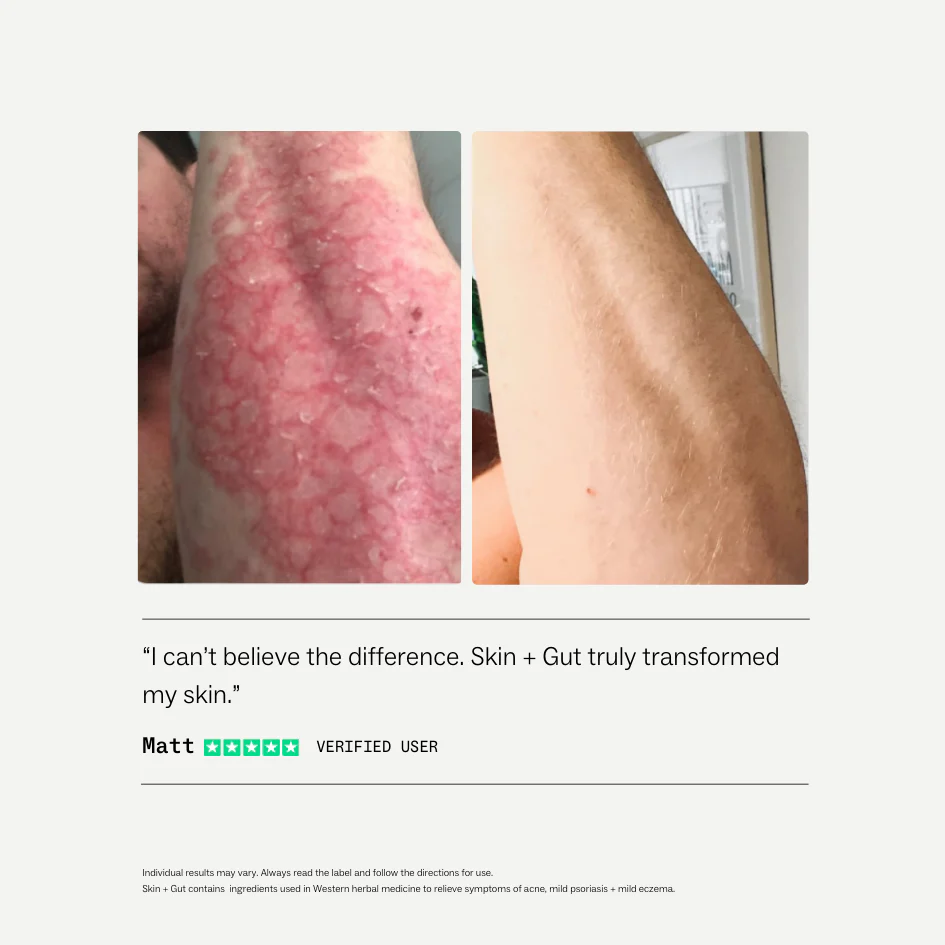 Skin + Gut® - Image 4