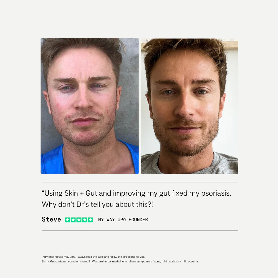 Skin + Gut® - Image 6